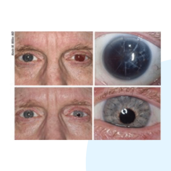Humanoptics - Image 2